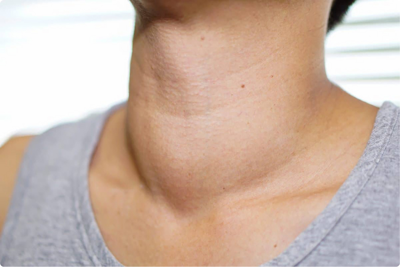 Ультразвуковое исследование позволяет выявить многие патологии щитовидной железы.